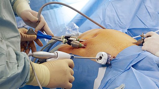 Laparoscopic & Hysteroscopic surgeries