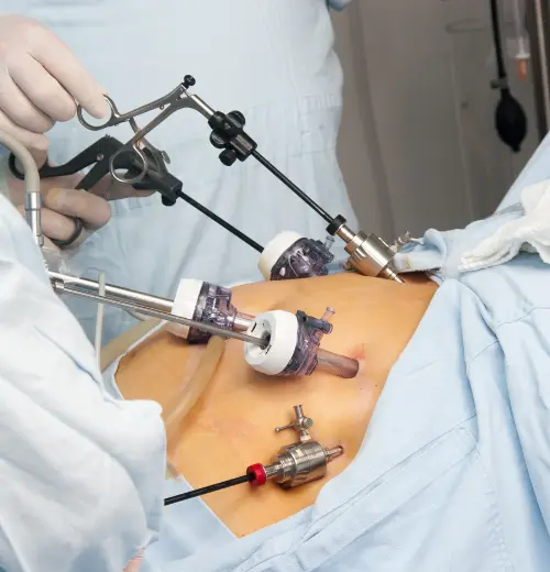 laparoscopic-and-hysteroscopic-surgeries